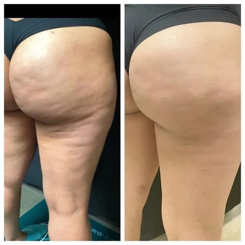 Legging Anti-Cellulite — photo d'un client 8